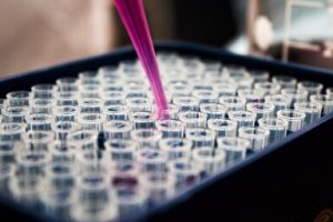 Diagnostic Lab Case Gallery 3 300x200 1