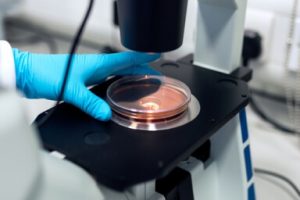 Diagnostic Lab Case Gallery 4 300x200 1